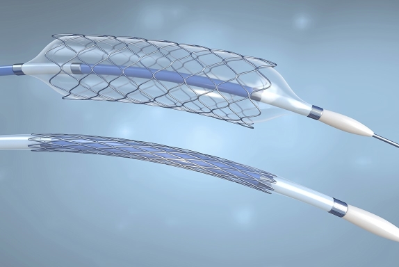 Corte de precisión de endoprótesis con láser de fibra óptica